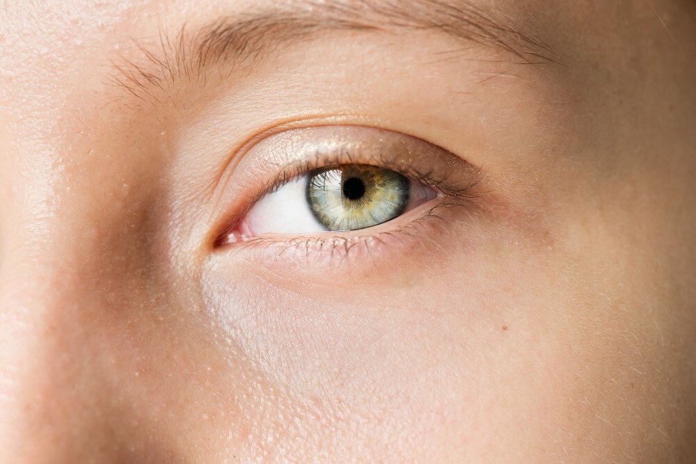 Nistagmus Nedir?