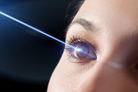 Excimer Lazer Nedir?