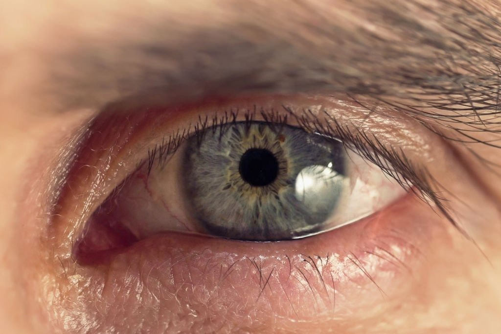 Kimler Renkli Lens Kullanamaz?