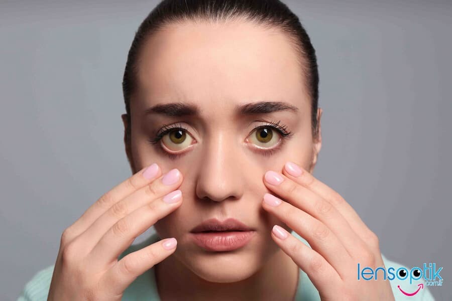 Sarı Nokta Hastalığı Nedir?